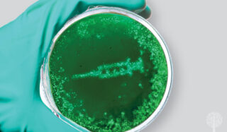 Mushroom Growing 101: What’s In A Spore Syringe?